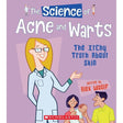 The Science of Acne and Warts: The Itchy Truth About Skin (The Science of the Body) by Alex Woolf
